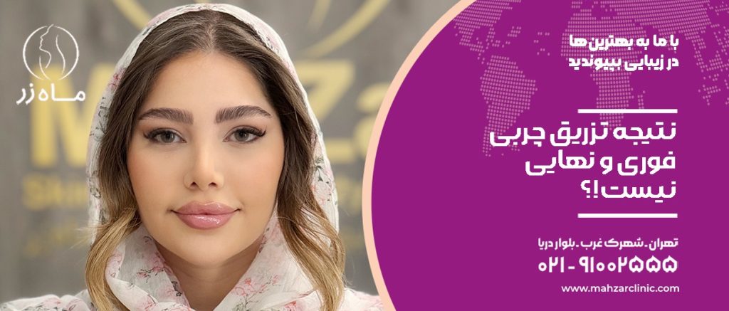 تزریق چربی؛ باورهای غلطی که باید اصلاح شوند
